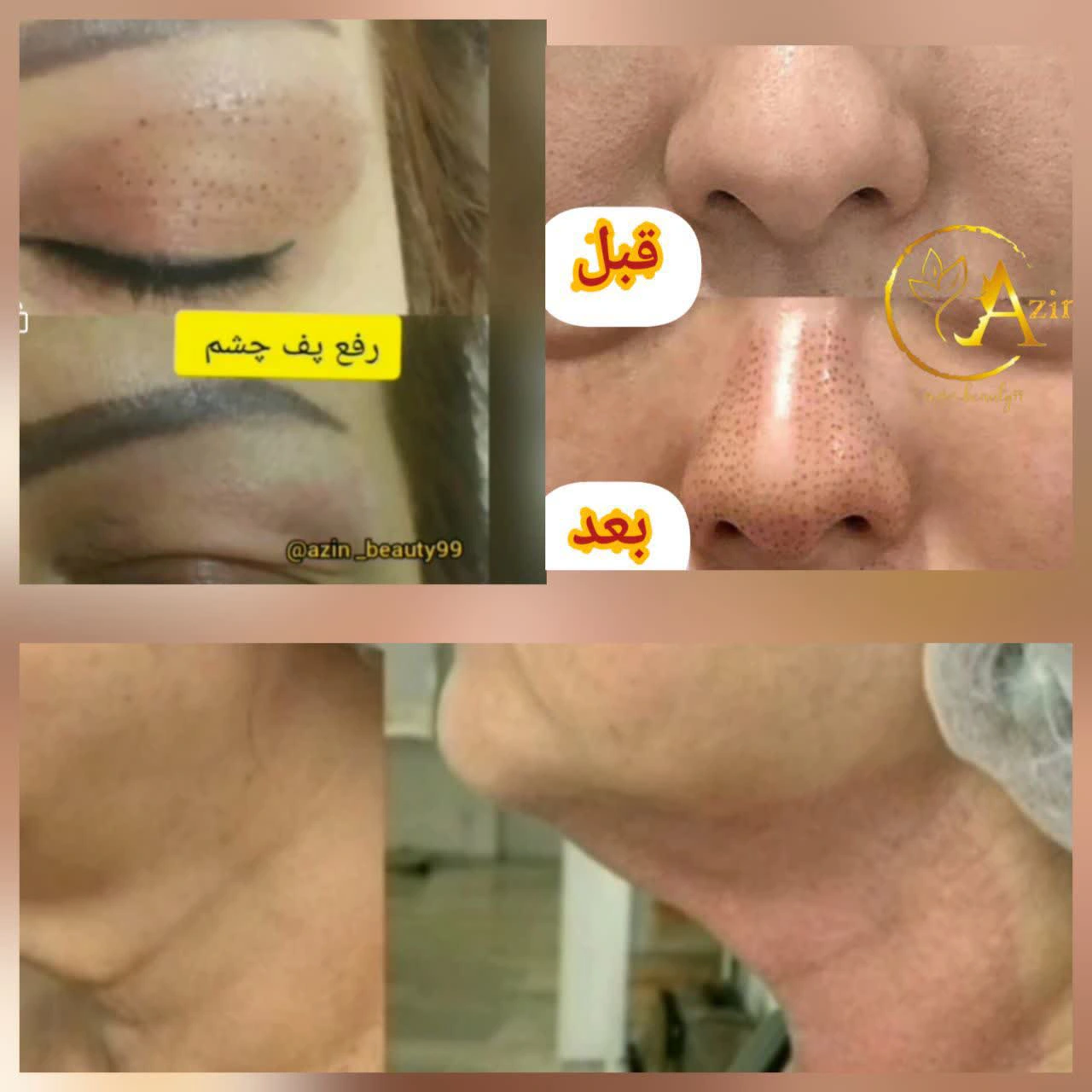 خدمات پلکسر