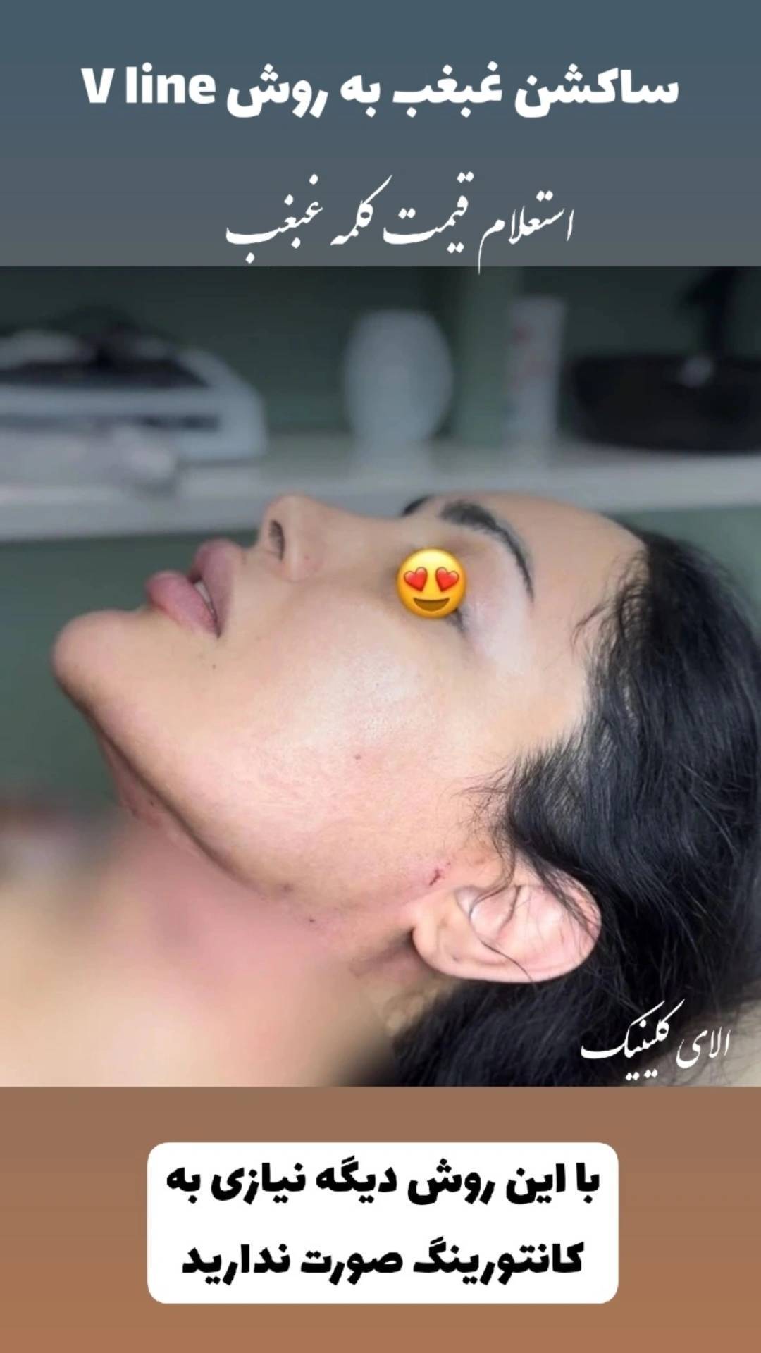گالری کلینیک زیبایی و لیزر اِلای