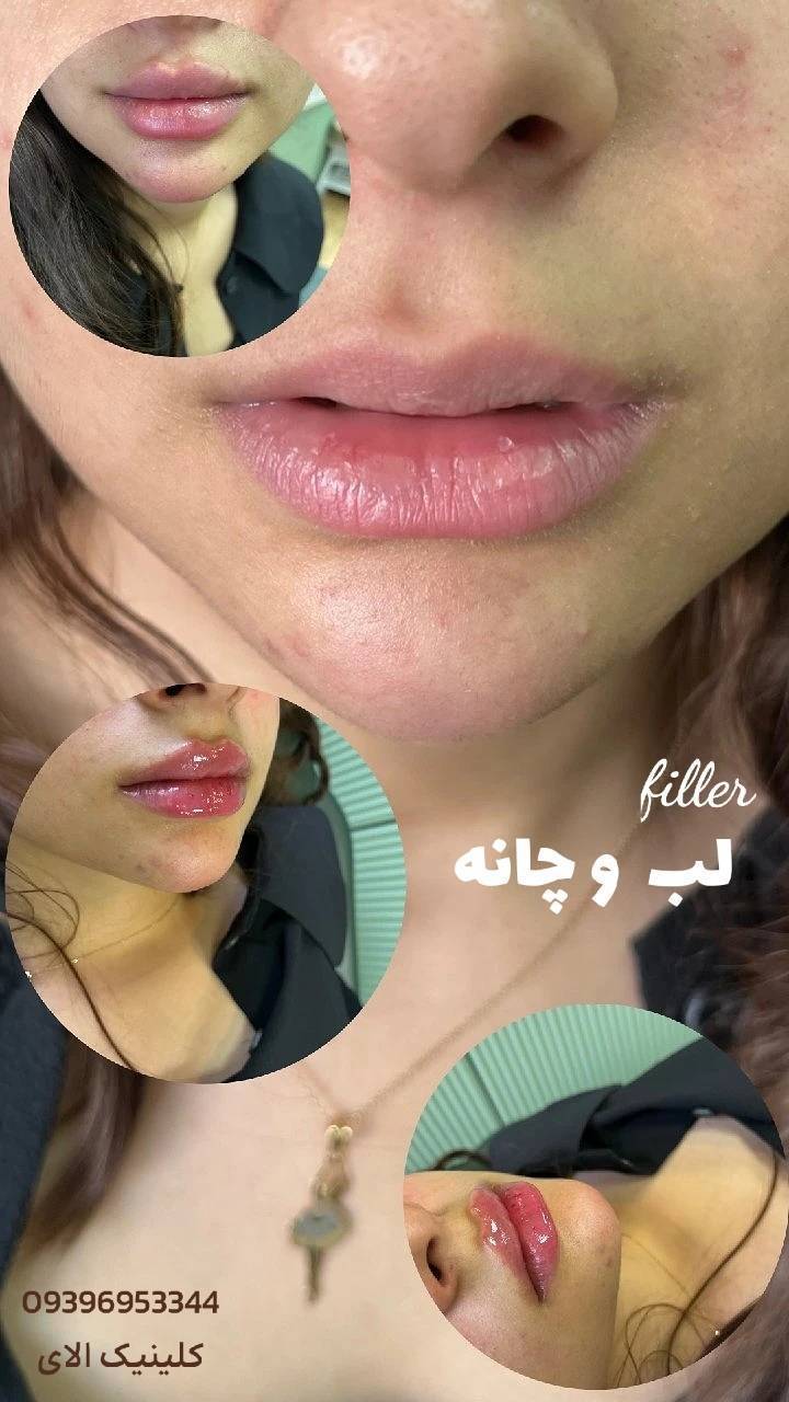 گالری کلینیک زیبایی و لیزر اِلای