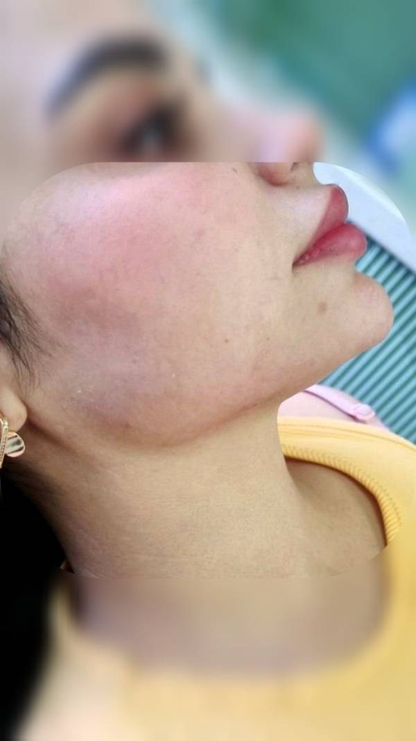 گالری کلینیک زیبایی و لیزر اِلای