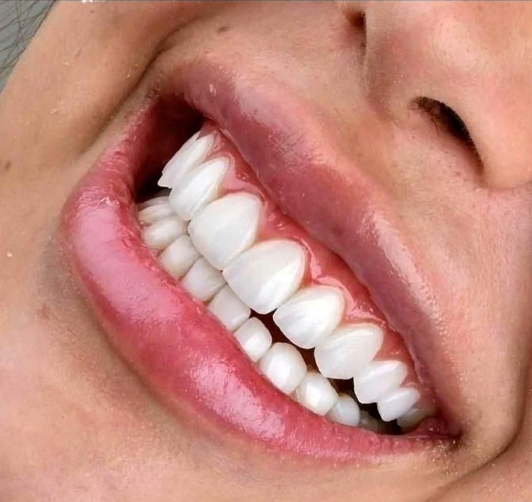 گالری مرکز دندانپزشکی دکتر سلیمی
