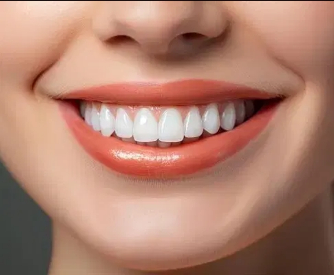 گالری مرکز دندانپزشکی دکتر سلیمی