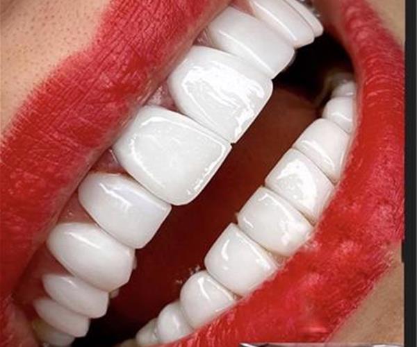 گالری لبخند زیبا