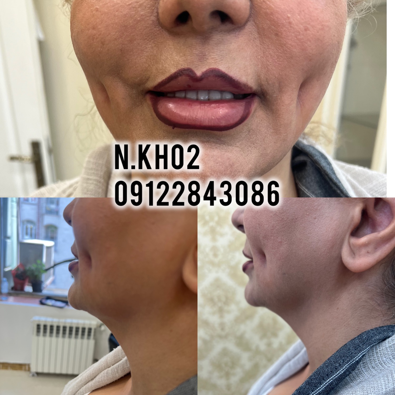 گالری آموزش و خدمات پرسینگ و کراتین پانچ گوش و میکرودرمال