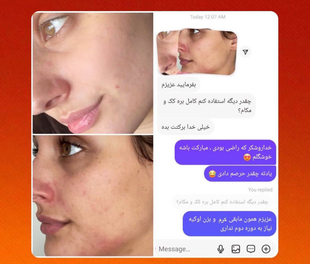 رضایت مشتری