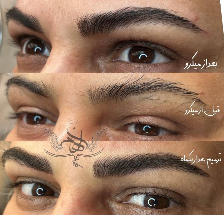 میکرو با مواد گیاهی