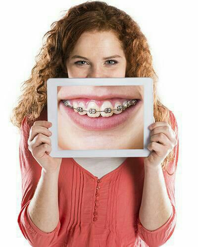 ارتودنسی متحرک یک فک همراه با وسیله خارجی دهانی 