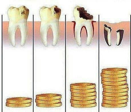 درمان ریشه دو کانال